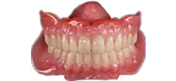Single Day Dentures