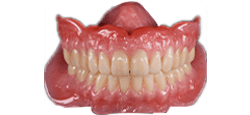 Single Day Dentures